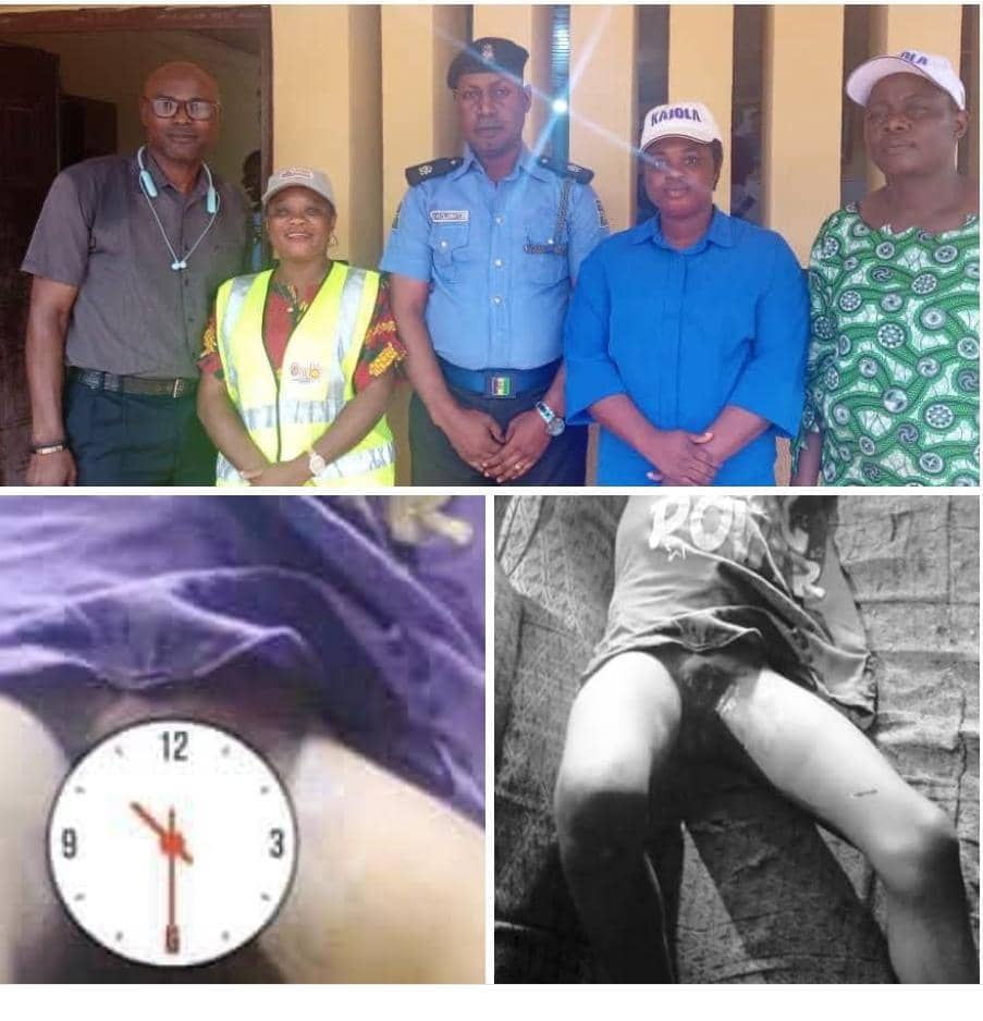 ONDO STATE GOVERNMENT REAFFIRMS ZERO TOLERANCE FOR CHILD ABUSE; VOWS TO PROSECUTE FATHER WHO ALLEGEDLY TORTURED HIS DAUGHTER